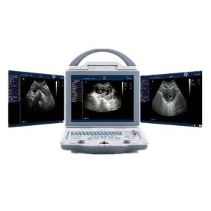 Hospital Ultrasound Machine Portable Ultrasound Scanner with Dual Probe
