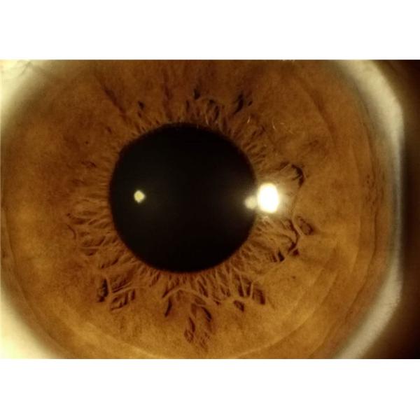 Digital Hand-held Slit Lamp Opthalmology Equipment Used For Anterior Segment Imaging 10X Magnification 16MP Resolution