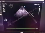 PHiliph EPiQ Series Ultrasound Array Transducer Probe X5-1 XMATRIX