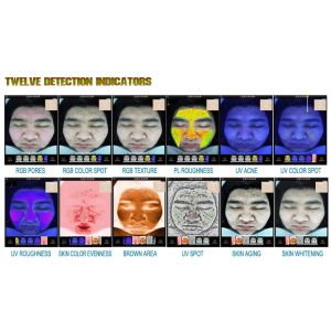UV PL Skin Moisture Analyser 45W Magic Mirror Tester For Dermatology