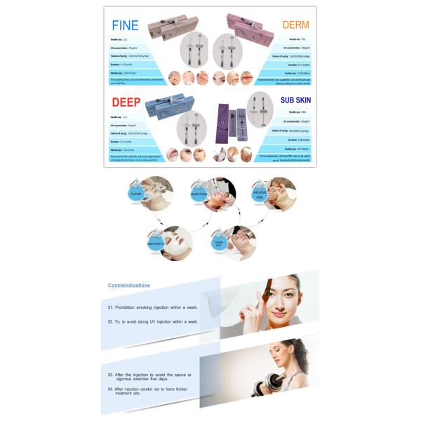 Fosyderm Injectable Dermal Filler Lift Age Reducing Treatment