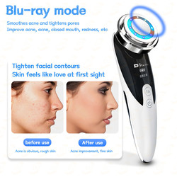 Radio Mesotherapy Skin Rejuvenation Face Massage Electroporation Lifting Beauty