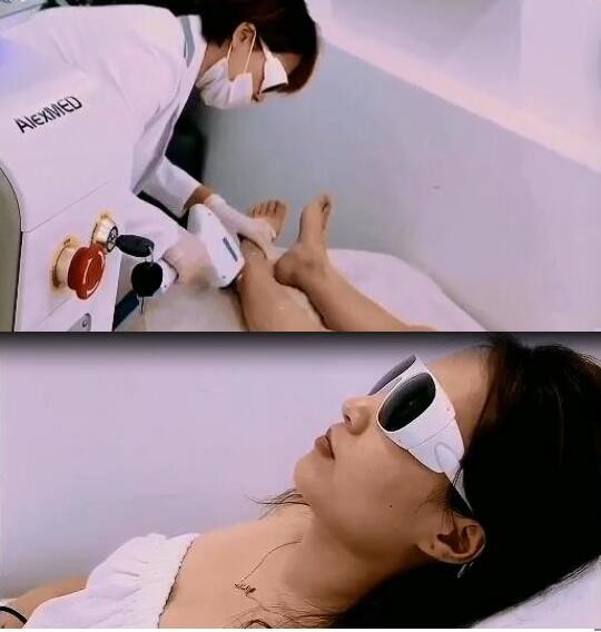 10hz Lasertell Triple Wave Diode Laser Hair Removal