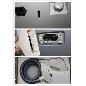 Newest technology for cosmetically hair removal and skin rejuvenation with SHR