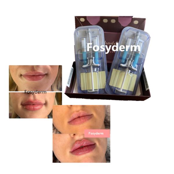 Buy Juvederm Volbella Hyaluronic Acid Lips Filler Cross Linked 24mg at wholesale prices