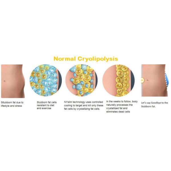 Cryotherapy Fat Burning Touchscreen Vacuum Slimming Machine