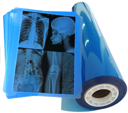 210um 8x10 A3 A4 Blue Medical Inkjet Film For Radiology X-Ray Imaging Output
