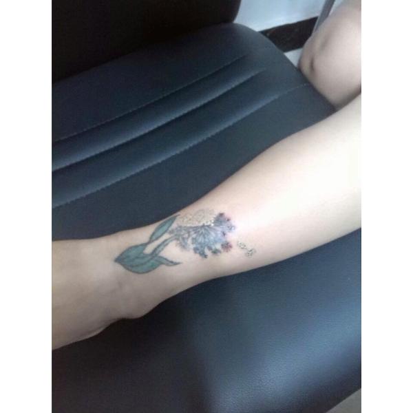 SQ-2 1064nm 532nm nd:yag laser tattoo removal machine/nd:yag laser q switch/portable q switch nd yag