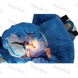 Sterile Surgical C Section Drape With Fenestration Obsterics Gynecology Drape