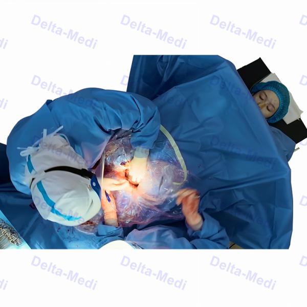 Sterile Surgical C Section Drape With Fenestration Obsterics Gynecology Drape