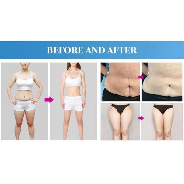 Anti Wrinkle RF 40k Vacuum Cavitation Body Slimming Machine
