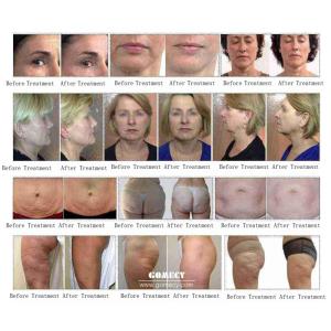 Mechanical Massage Instrument Bidirectional Electric Roller Nursing Head Device