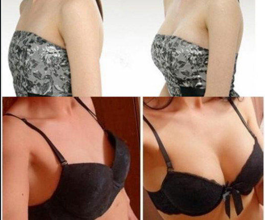 1ml Breast Filler Hyaluronic Acid 24mg/Ml For Wrinkles Nasolabial Grooves Body