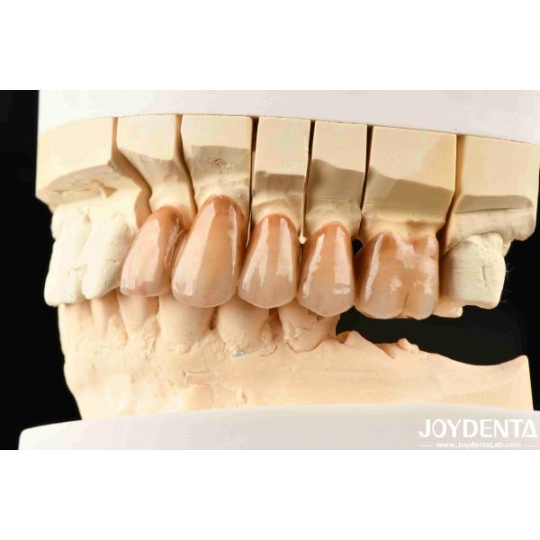 Buy Bionic Development Leaves And Distinct Layers Of Zirconia All-Ceramic at wholesale prices