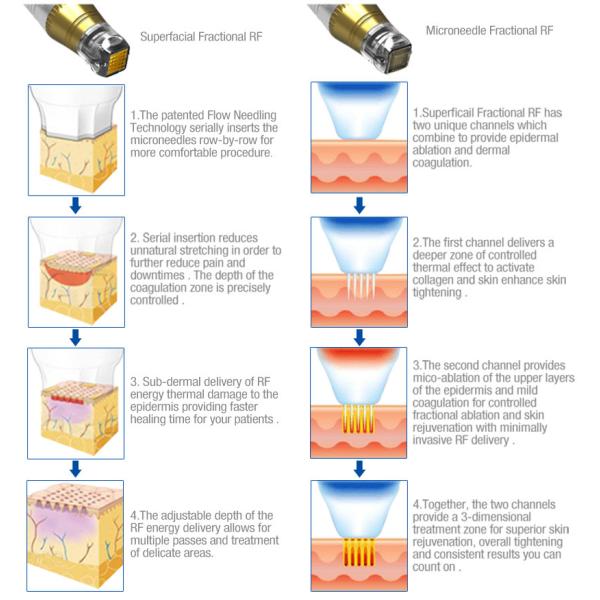 5Mhz Scar Removal Face Lifting Microneedle RF Machine