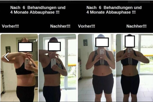 Beautiful Design High Quality Manufacturer Direct Sale Portable Cryolipolysis Machine For