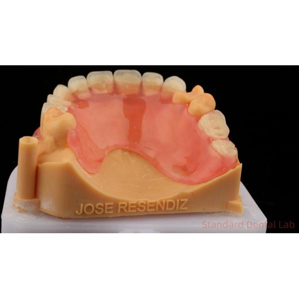 3D Print Model Dental TCS Valplast Flexible Partial Dentures Pink / Dark Color Dental Lab Product