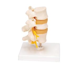 0.45kg Medical Anatomy Education 20x16x10cm Lumbar Spine Model