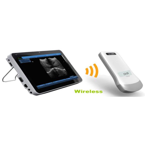 Portable Ultrasonic Diagnostic Devices Type wireless ultrasound with convex probe