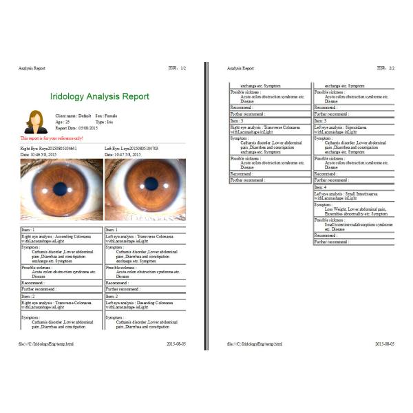 Left And Right Lamp Iriscope Iridology Camera Analyzer English Spanish Chinese Language