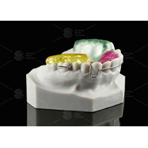 Acrylic Twin Block Orthodontic Appliance For Correcting Malocclusion