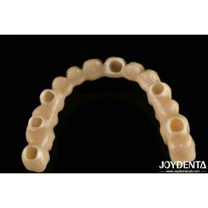 Custom Made Polished Titanium Abutment Cement Retetion V Shaped Thread Type