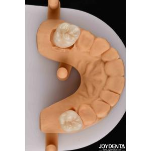 Natural-looking Esthetics With Biocompatible Dental Zirconia Winning Combination