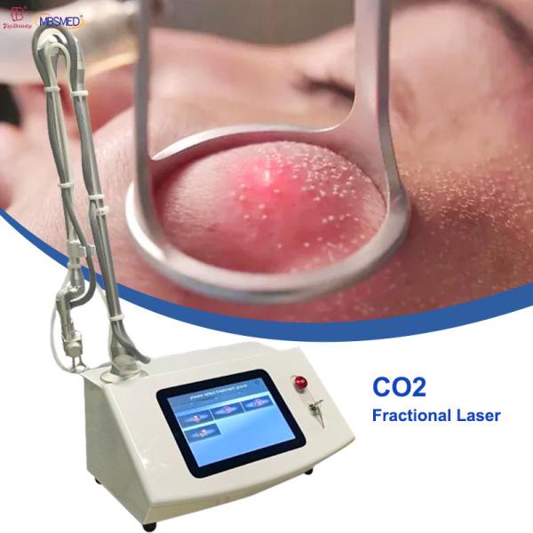 Vaginal Tightening Q Switched Nd Yag Carbon Fractional Co2 Laser Vaginal
