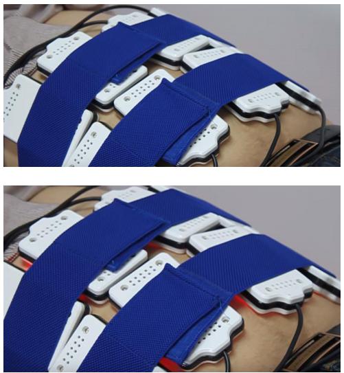 CE Standard Cryotherapy Body Slimming Equipment With Big Fat Freeze Handle