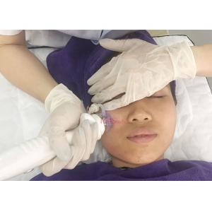 Noninvasive Weight Loss 10 Pins Microneedling Rf Machine