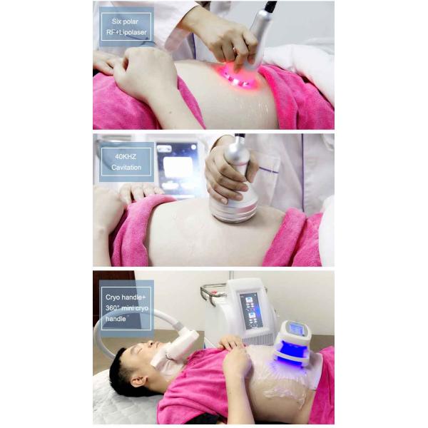 Vertical 2 Cryo Handles Work At The Same Time Cryolipolysis Weight Loss Machine