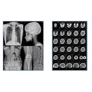 Sheet Blue Xray Film Inkjet Medical Dry Film Clear Image
