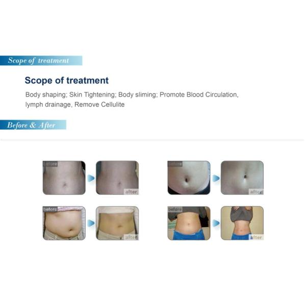 2019 fast slim weight loss portable cryo therapy cryolipolysis body shaping machine