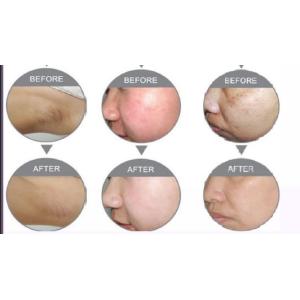 Portable No Needles Mesotharapy needle free beauty equipment machine