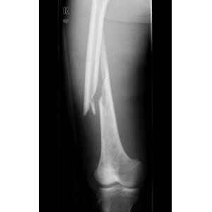 Konida Laser X Ray Medical Imaging