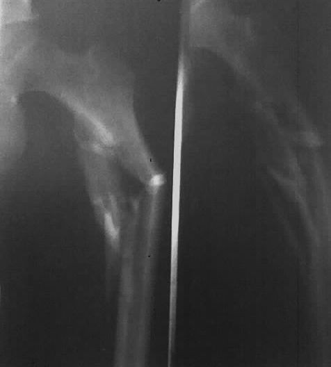 Buy Fuji Medical Thermal Printer Film at wholesale prices