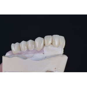 43%-57% Translucency 700-1200 MPa Bending Strength YUCERA Dental 89mm CAD/CAM 4D