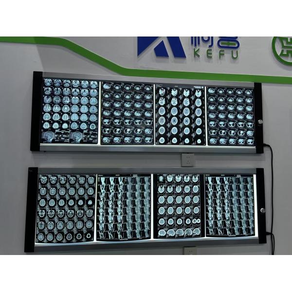 Buy Automatic Medical Film for X Ray Density Adjustable Laser Imaging Crystal Clear Results at wholesale prices