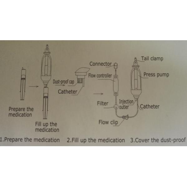 Cbi Type Anaesthesia Disposable Infusion Pump Pca With 2ml / H Flow Rate