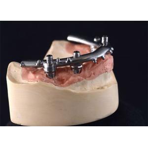 High-Density PFM Dental Implants Dentures Strong Hardness Long Lasting​