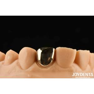 Quality Experience Oral Rehabilitation Like Never Before With Gold Crown Wax Casting for sale