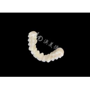 Long-lasting Bonding PFM Dental Crown Bridge With Excellent Biocompatibility