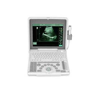 Digital Portable Mobile Laptop Ultrasound Scanner Medical Equipment BIO 3000J With 1.12 Inch LED Screen
