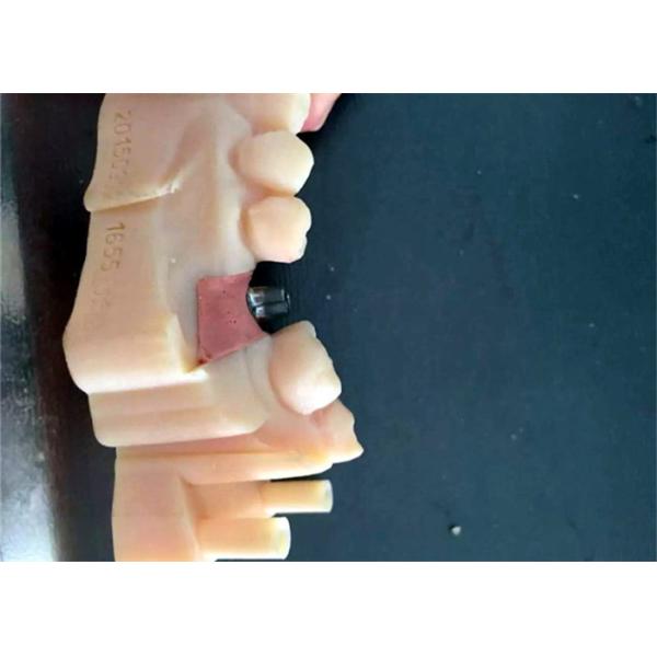 CAD / CAM PFM Dental Crowns Bridge Resin Material Good Biocompatibility