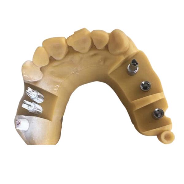 Buy Digital Biocompatibility PFM Dental Crown 3D Printing Temporary Crowns at wholesale prices