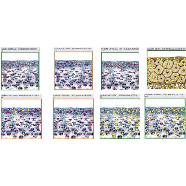 Metatron hunter 4025 with german software