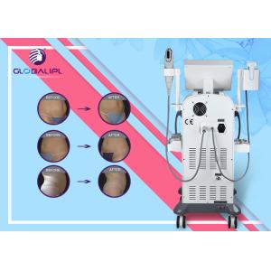 Sophisticated Technology Massage Body Slimming HIFU Face Lift Machine