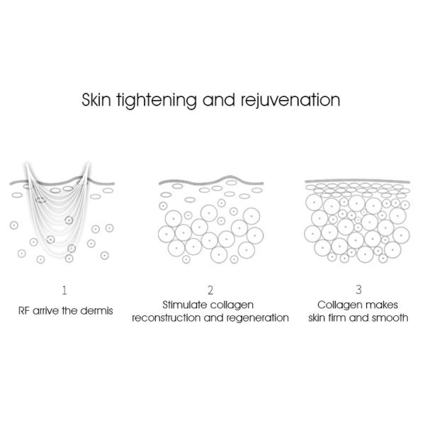 Mini Hifu Beauty Machine One Shot 22 Dots for Face Lifting Anti Aging