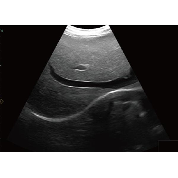 256 Frame Cine Portable Ultrasound Scanner 128 Permanent Storage With 12 Inch Screen