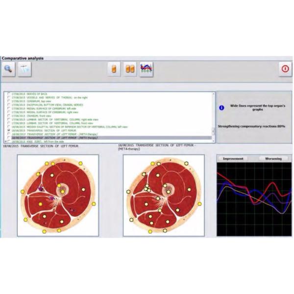 Metatron hunter 4025 with german software